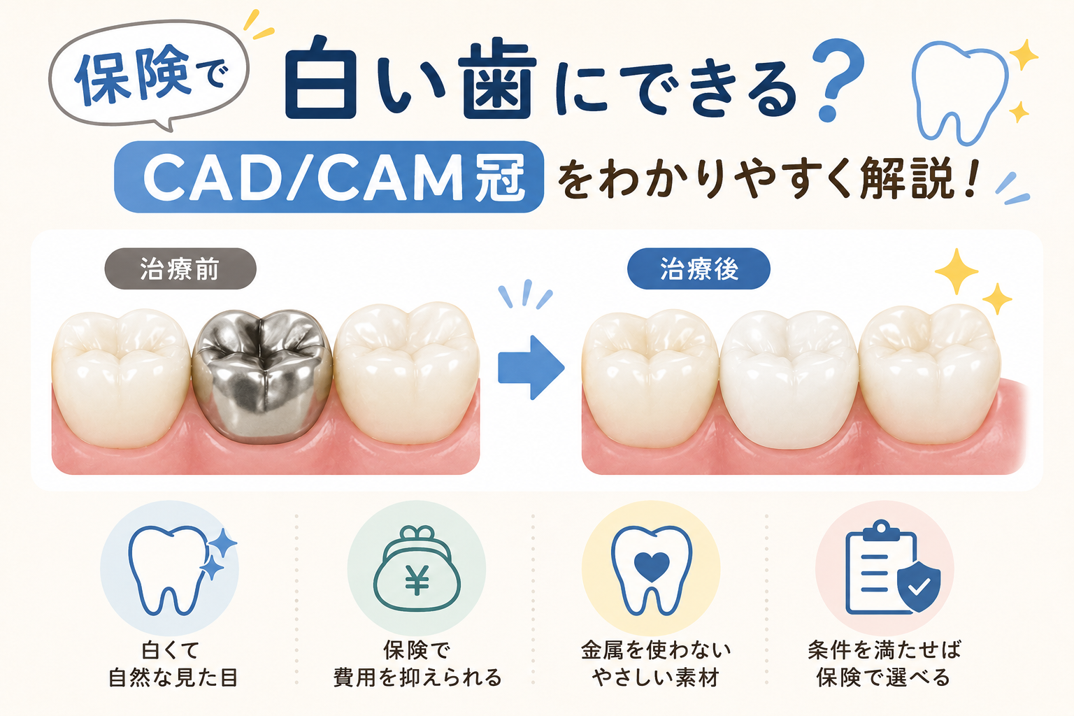 「白い歯にしたいけど、種類が多くて分からない…」