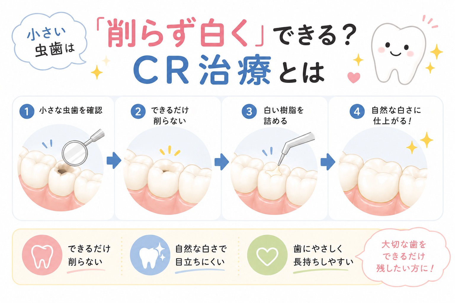 「虫歯って、やっぱり大きく削るんですか？」