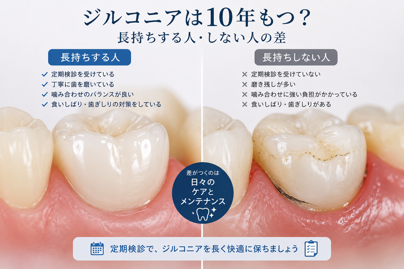 「ジルコニアって、どれくらい長持ちするの？」